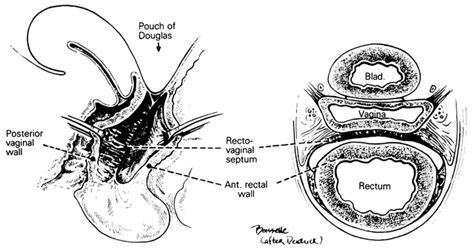 teen vagina pic|Category : Human surface anatomy of vulva .